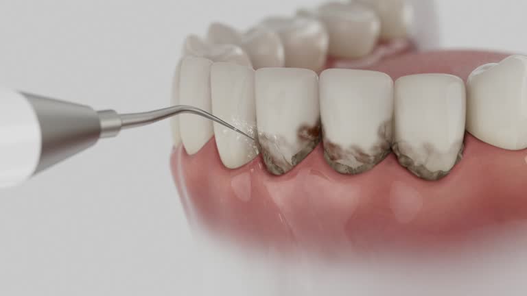 Reliable Dental Implants contractor in Orange Cove, CA by Smile Center Dentistry
